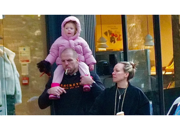 Rugby player James Haskell reveals hair transplant while co-parenting with ex-wife Chloe Madeley.