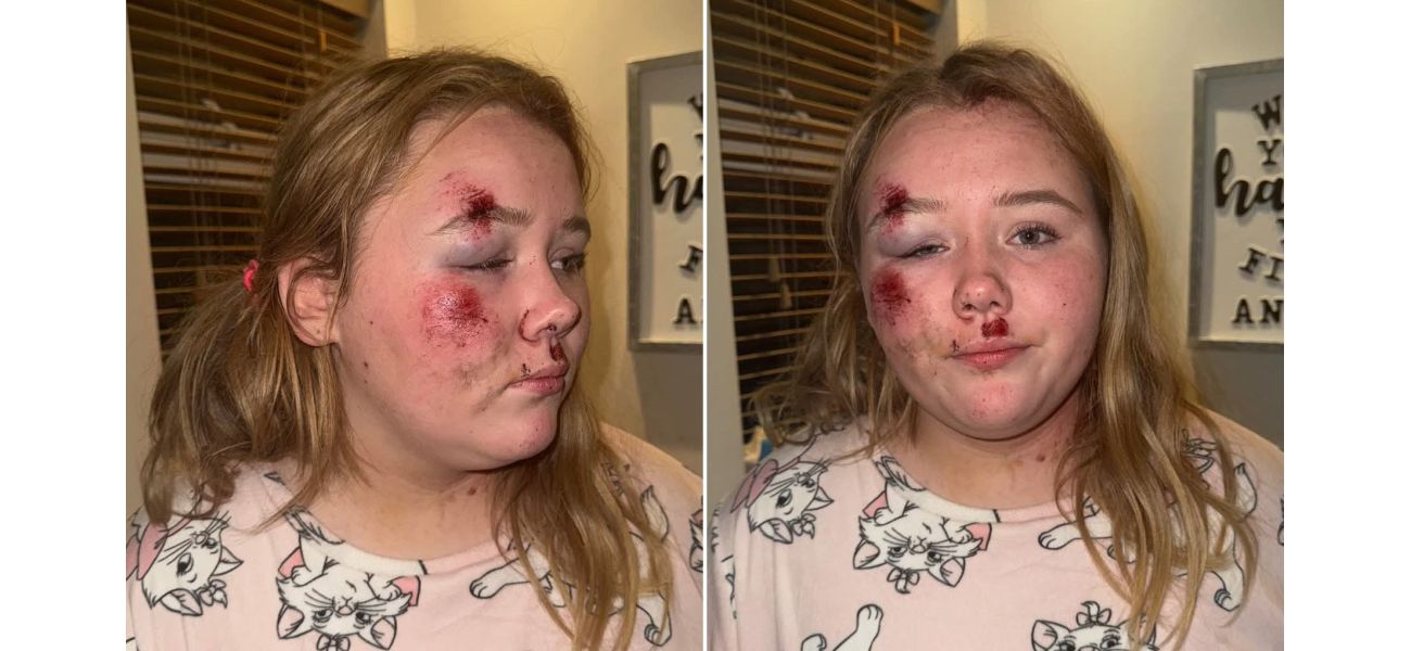 12-year-old girl injured on road in hit-and-run.