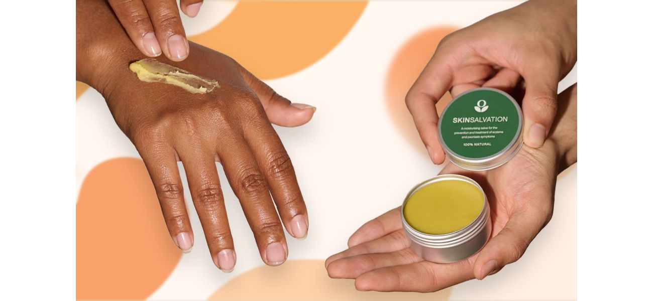 Get 20% off Balmonds skincare balm for eczema now! Learn how to redeem the discount.