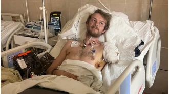 British volunteer injured in drone attack in Ukraine undergoes amputation of arm and leg.