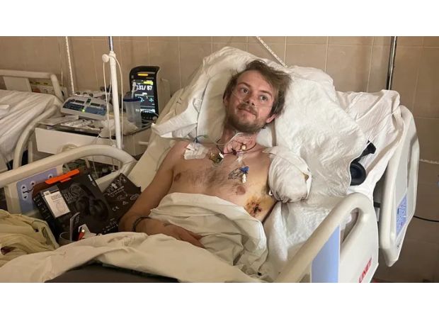 British volunteer injured in drone attack in Ukraine undergoes amputation of arm and leg.