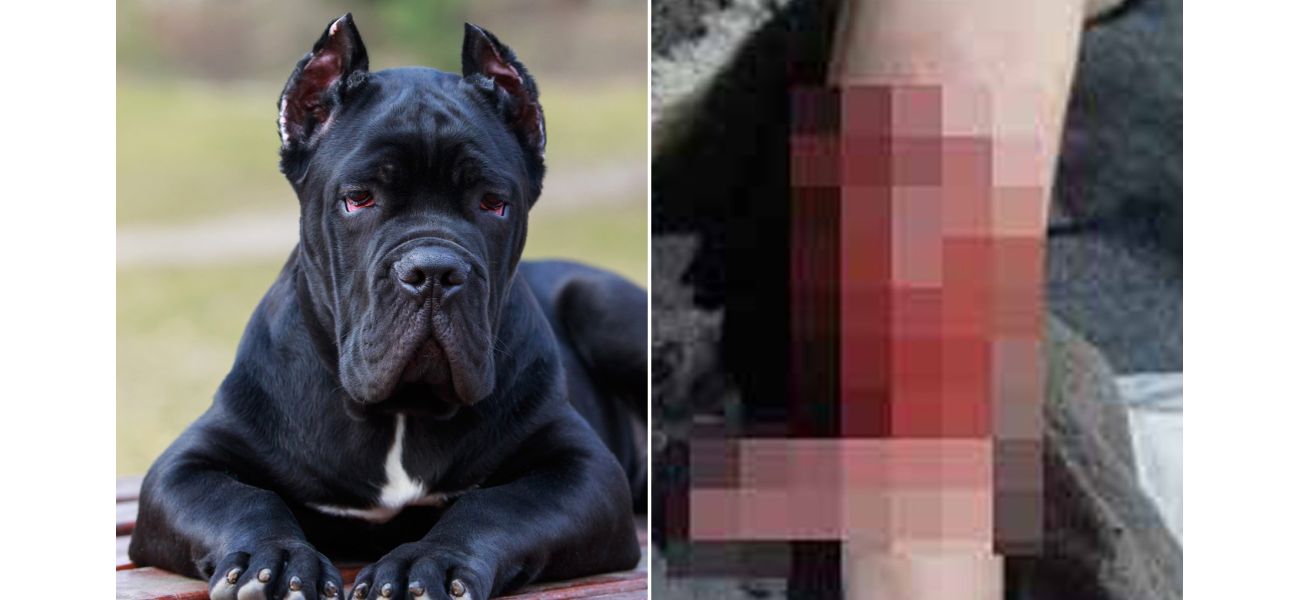 Three kids injured by their own dogs in less than two days.