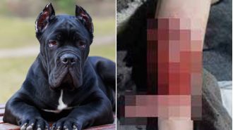 Three kids injured by their own dogs in less than two days.
