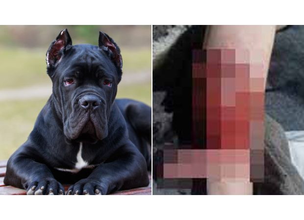 Three kids injured by their own dogs in less than two days.