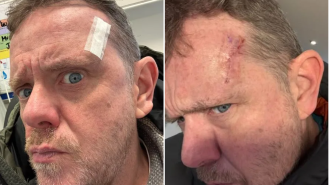 Emmerdale actor has operation to eliminate cancer cells.