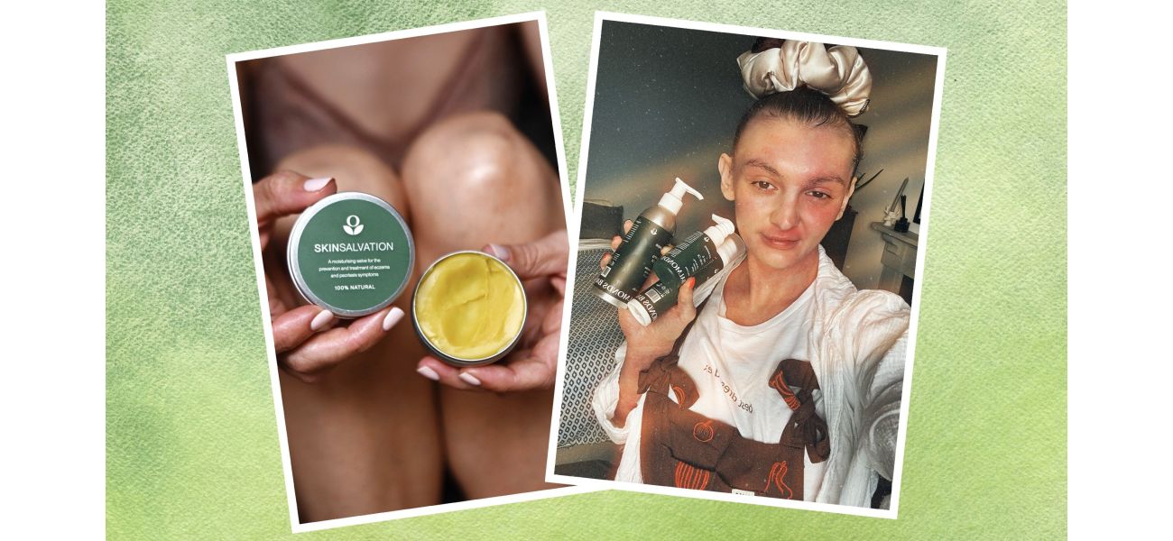 A popular actor loves this £9 skincare balm from Sex Education and recommends it highly.