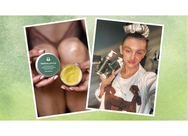 A popular actor loves this £9 skincare balm from Sex Education and recommends it highly.