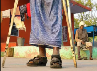 Leprosy is on the rise in Odisha due to neglect and reduced funding.