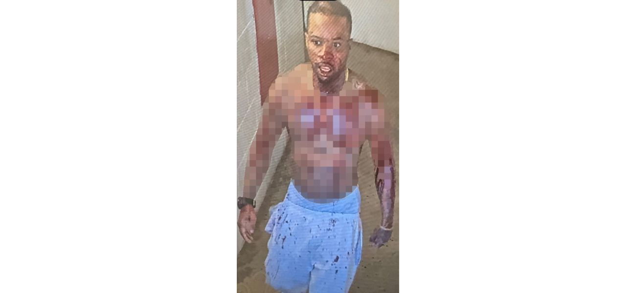Tory Lanez brutally attacked in jail, stabbed 14 times.