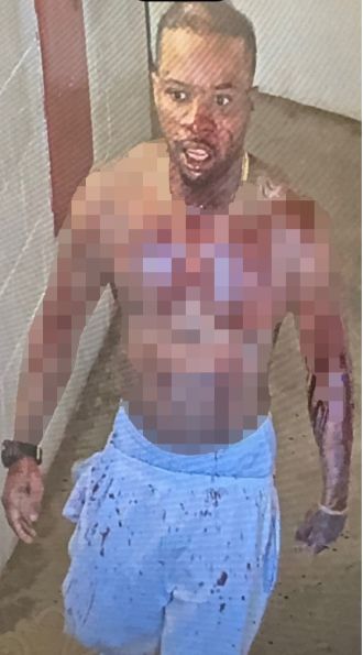 Tory Lanez brutally attacked in jail, stabbed 14 times.