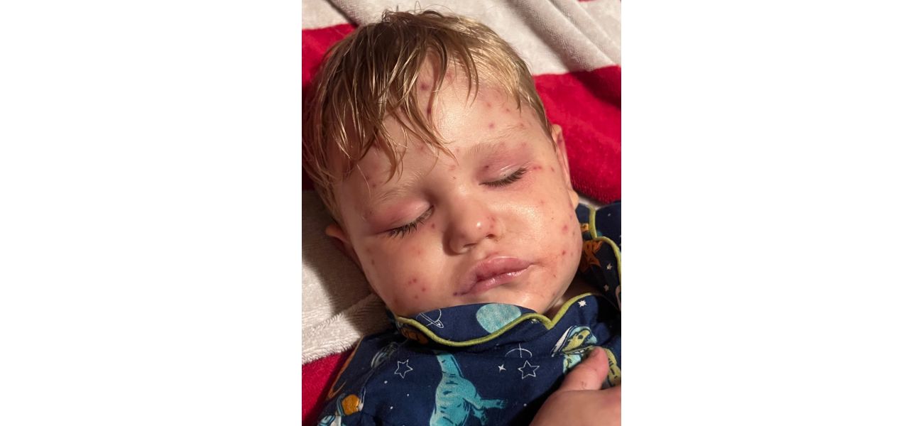 2-year-old boy in critical condition after being stung by 150 wasps while riding toy car.