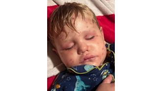 2-year-old boy in critical condition after being stung by 150 wasps while riding toy car.