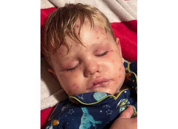 2-year-old boy in critical condition after being stung by 150 wasps while riding toy car.