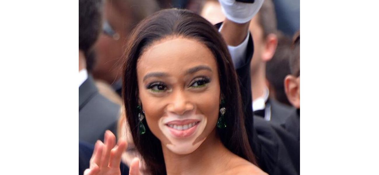 Winnie Harlow becomes first person with vitiligo to receive a Madame Tussauds wax figure.