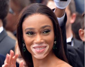 Winnie Harlow becomes first person with vitiligo to receive a Madame Tussauds wax figure.