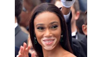 Winnie Harlow becomes first person with vitiligo to receive a Madame Tussauds wax figure.