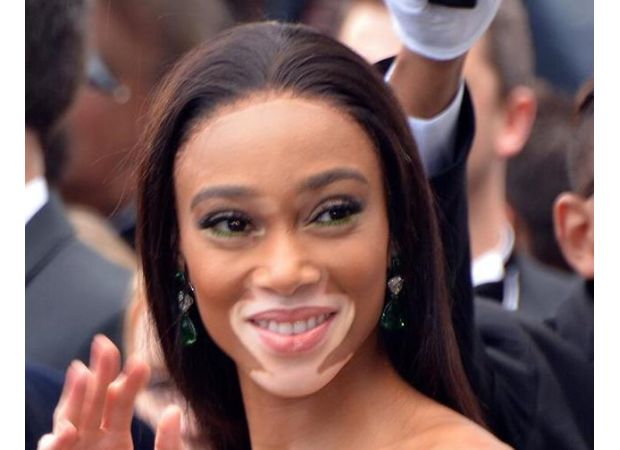 Winnie Harlow becomes first person with vitiligo to receive a Madame Tussauds wax figure.