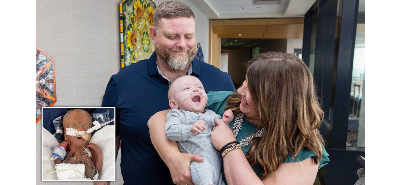 A baby born at just 21 weeks, who defied the odds and survived, celebrates their first birthday.