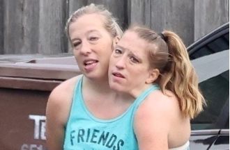 Conjoined twins Abby and Brittany share cryptic update after being seen with a baby.